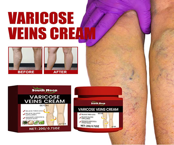 South Moon VARICOSE VEINS CREAM - CRÈME CONTRE LES VARICES